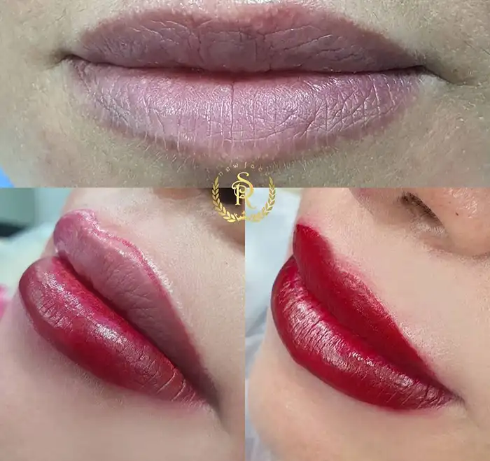 شیدلینگ لب - رویا احمدوند